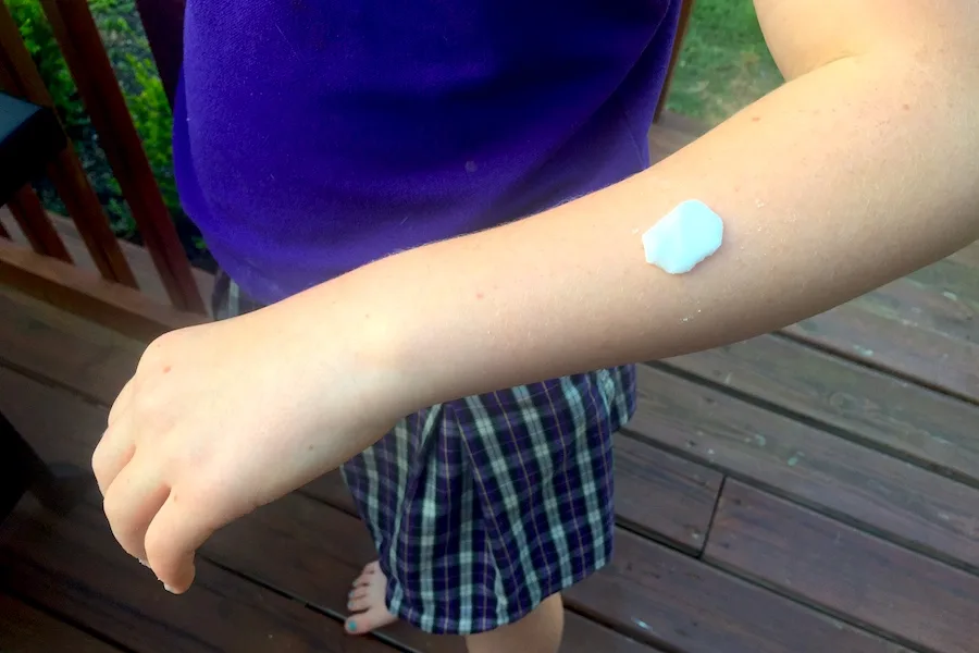 Our super-easy, non-toxic bug bite remedy that really works!