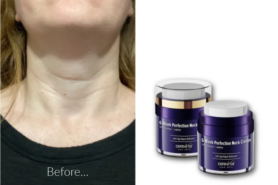 We tried the DefenAge Neck Perfecting Cream system for 6 weeks to see if it worked...